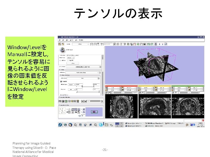 テンソルの表示 Window/Levelを Manualに設定し, テンソルを容易に 見られるように画 像の画素値を反 転させられるよう にWindow/Level を設定 Planning for Image Guided Therapy