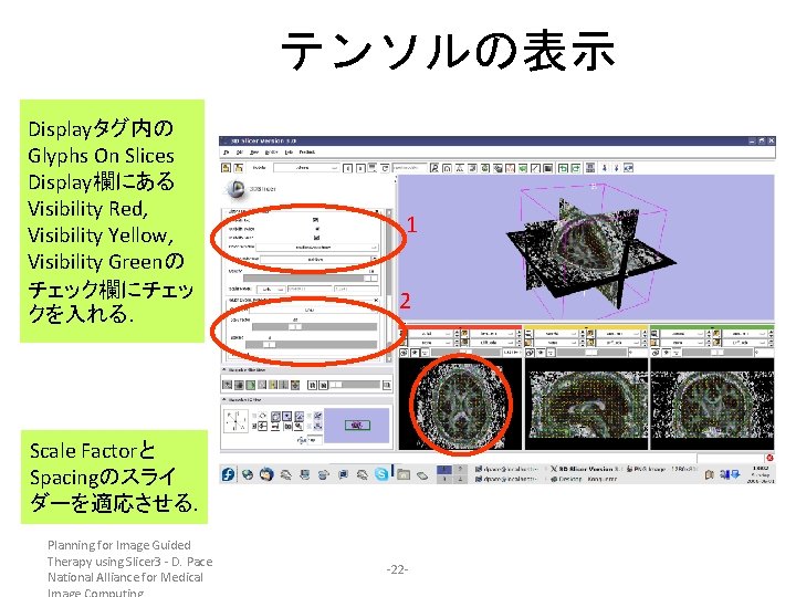 テンソルの表示 Displayタグ内の Glyphs On Slices Display欄にある Visibility Red, Visibility Yellow, Visibility Greenの チェック欄にチェッ クを入れる.