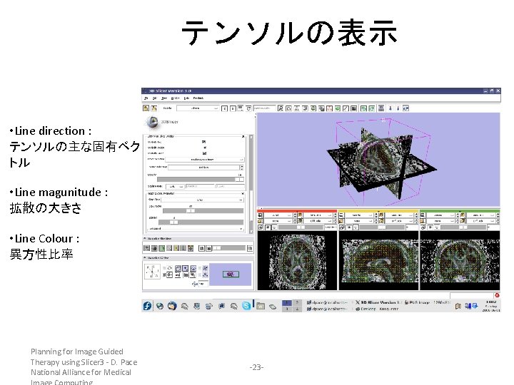 テンソルの表示 • Line direction : テンソルの主な固有ベク トル • Line magunitude : 拡散の大きさ • Line