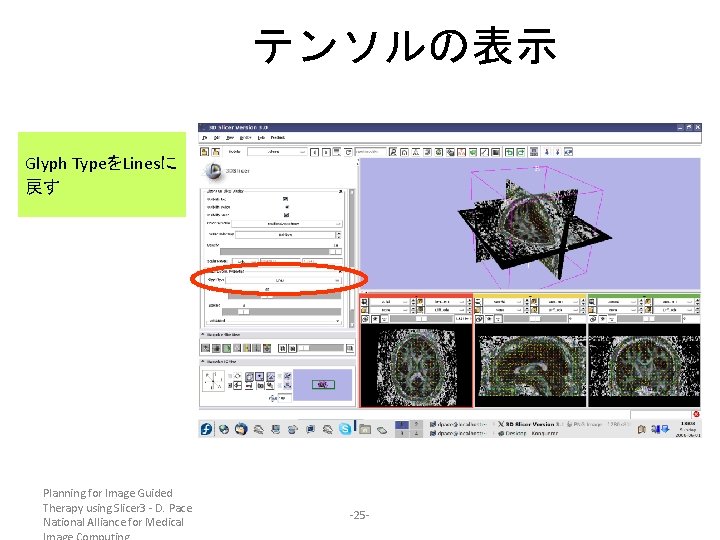 テンソルの表示 Glyph TypeをLinesに 戻す Planning for Image Guided Therapy using Slicer 3 - D.