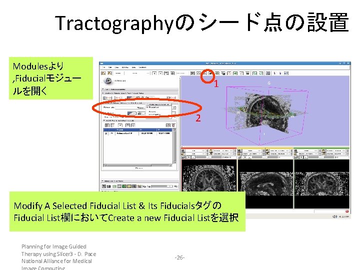 Tractographyのシード点の設置 Modulesより , Fiducialモジュー ルを開く 1 2 Modify A Selected Fiducial List & Its