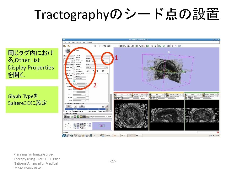 Tractographyのシード点の設置 同じタグ内におけ る, Other List Display Properties を開く. 1 2 Glyph Typeを Sphere 3