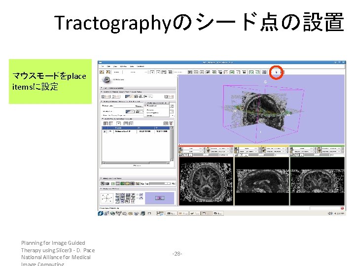 Tractographyのシード点の設置 マウスモードをplace itemsに設定 Planning for Image Guided Therapy using Slicer 3 - D. Pace