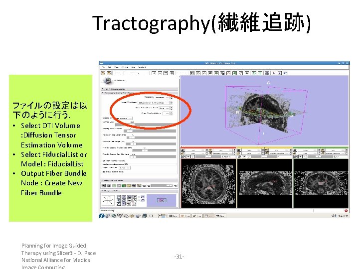 Tractography(繊維追跡) ファイルの設定は以 下のように行う. • Select DTI Volume : Diffusion Tensor Estimation Volume • Select