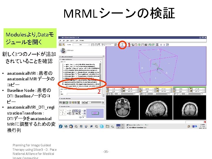 MRMLシーンの検証 Modulesより, Dataモ ジュールを開く 1 新しく 3つのノードが追加 されていることを確認 • anatomical. MRI：患者の anatomical MRIデータの コピー