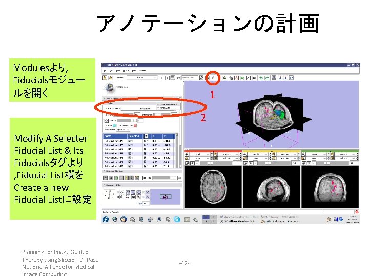 アノテーションの計画 Modulesより, Fiducialsモジュー ルを開く 1 2 Modify A Selecter Fiducial List & Its Fiducialsタグより