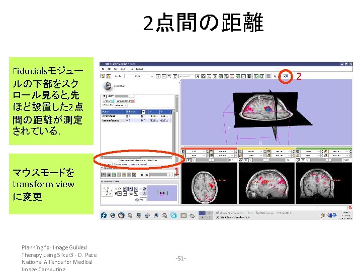 2点間の距離 Fiducialsモジュー ルの下部をスク ロール見ると, 先 ほど設置した 2点 間の距離が測定 されている. マウスモードを transform view に変更 Planning