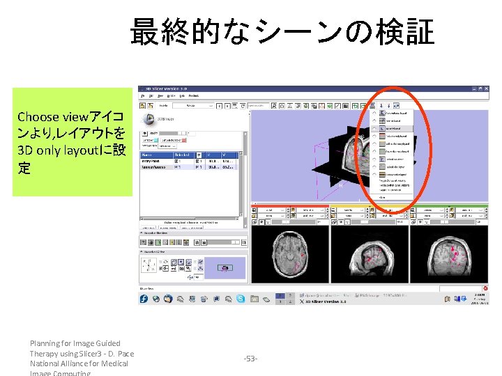 最終的なシーンの検証 Choose viewアイコ ンより, レイアウトを 3 D only layoutに設 定 Planning for Image Guided