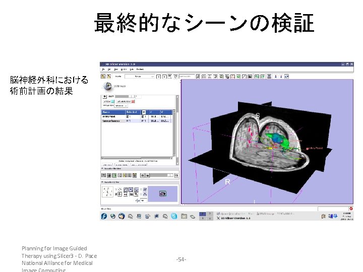 最終的なシーンの検証 脳神経外科における 術前計画の結果 Planning for Image Guided Therapy using Slicer 3 - D. Pace