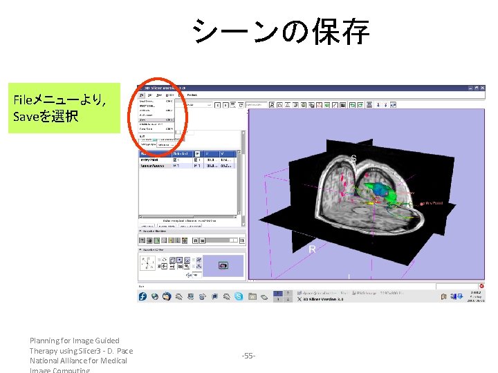 シーンの保存 Fileメニューより, Saveを選択 Planning for Image Guided Therapy using Slicer 3 - D. Pace