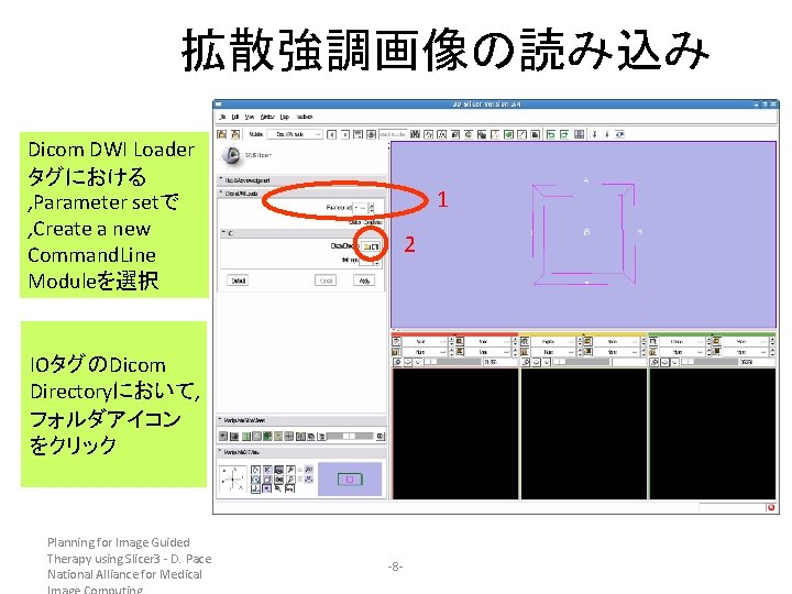 拡散強調画像の読み込み Dicom DWI Loader タグにおける , Parameter setで , Create a new Command. Line