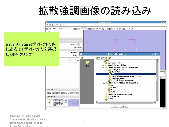 拡散強調画像の読み込み patient datasetディレクトリ内 にある, DTIディレクトリを選択 し, OKをクリック Planning for Image Guided Therapy using Slicer