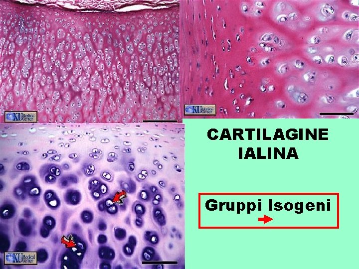 CARTILAGINE IALINA Gruppi Isogeni 