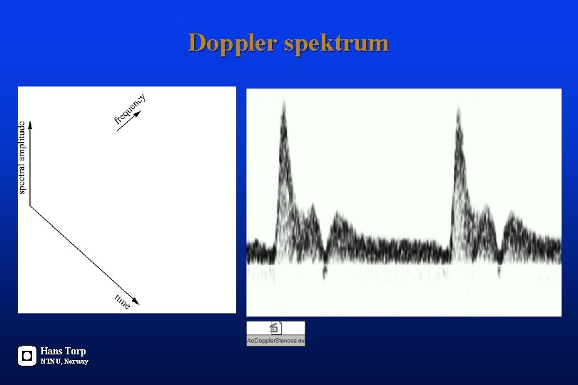 Doppler spektrum Hans Torp NTNU, Norway 