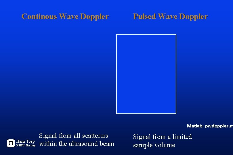 Continous Wave Doppler Pulsed Wave Doppler Matlab: pwdoppler. m Hans Torp NTNU, Norway Signal