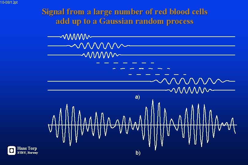 10 -08/12 pt Signal from a large number of red blood cells add up