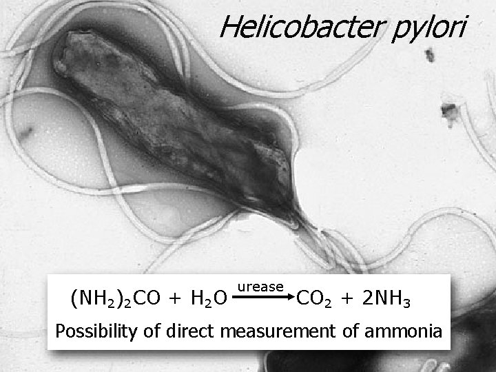 Breath Analysis by Cavity Ring Down Spectroscopy Joseph