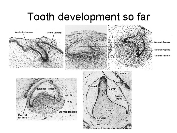 Tooth development so far 