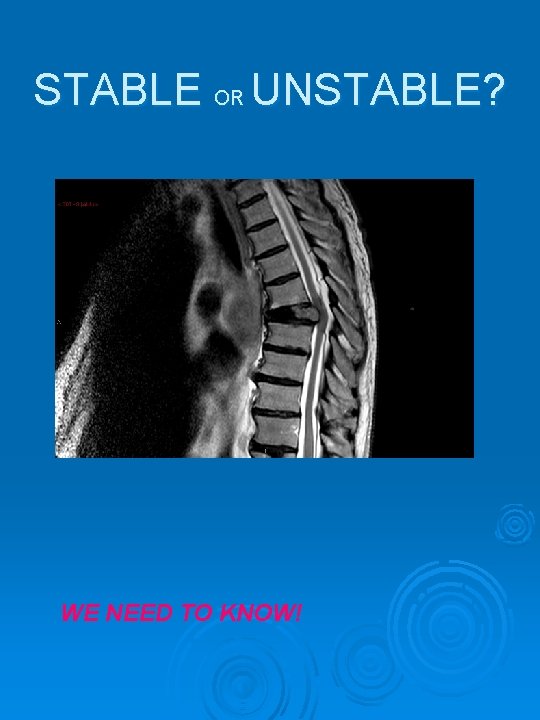 STABLE OR UNSTABLE? WE NEED TO KNOW! 