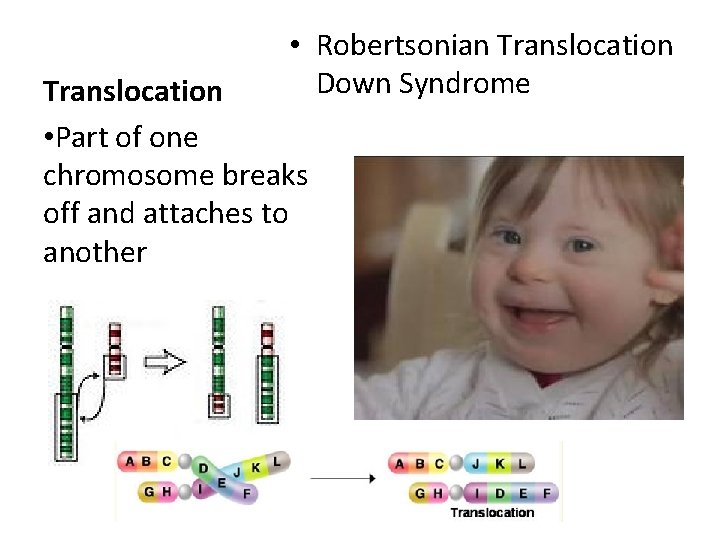  • Robertsonian Translocation Down Syndrome Translocation • Part of one chromosome breaks off