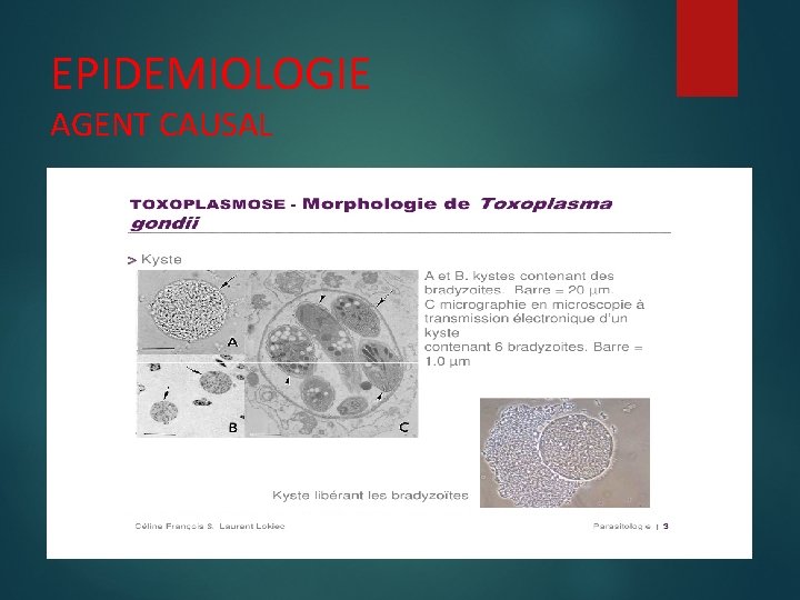 EPIDEMIOLOGIE AGENT CAUSAL 