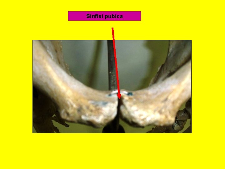 Sinfisi pubica 