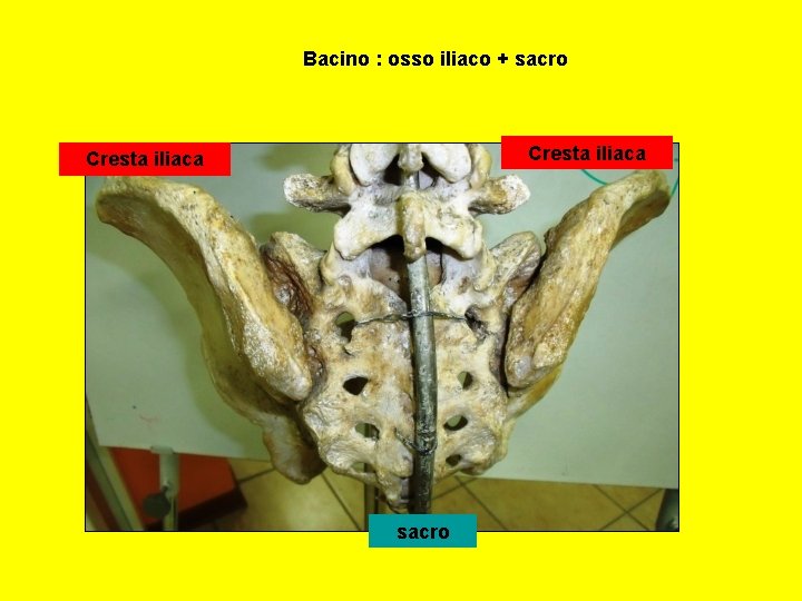 Bacino : osso iliaco + sacro Cresta iliaca sacro 