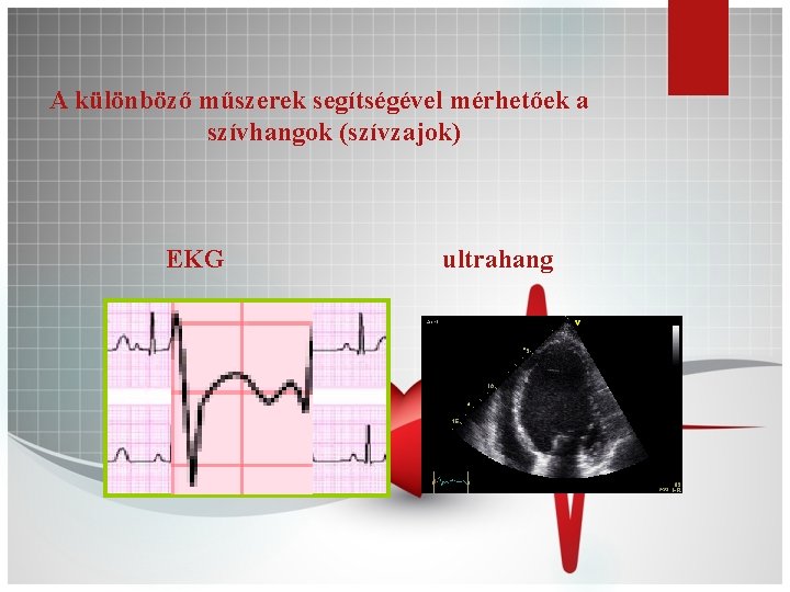 A különböző műszerek segítségével mérhetőek a szívhangok (szívzajok) EKG ultrahang 