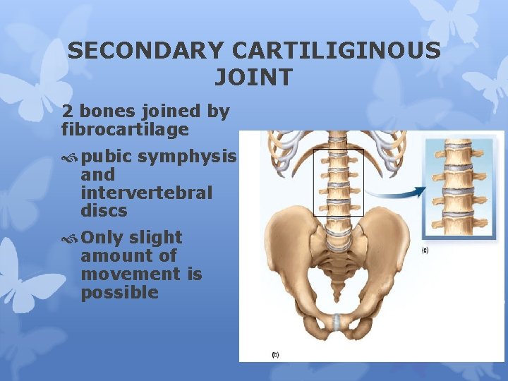 SECONDARY CARTILIGINOUS JOINT 2 bones joined by fibrocartilage pubic symphysis and intervertebral discs Only