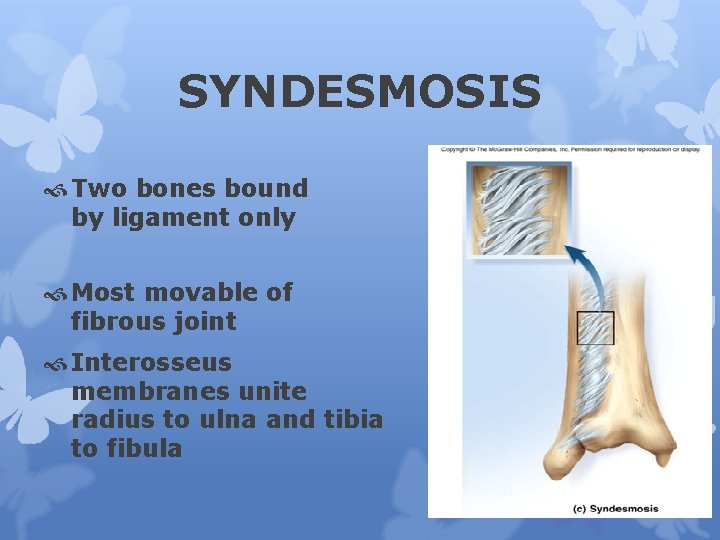 SYNDESMOSIS Two bones bound by ligament only Most movable of fibrous joint Interosseus membranes