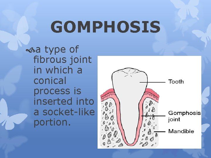 GOMPHOSIS a type of fibrous joint in which a conical process is inserted into
