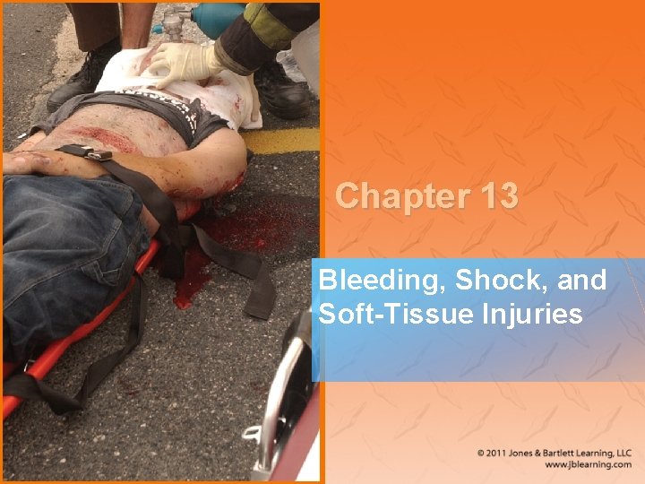 Chapter 13 Bleeding, Shock, and Soft-Tissue Injuries 