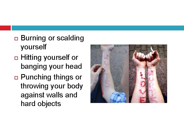  Burning or scalding yourself Hitting yourself or banging your head Punching things or