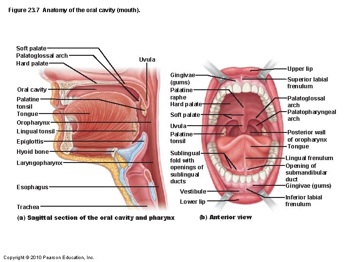 Figure 23. 7 Anatomy of the oral cavity (mouth). Soft palate Palatoglossal arch Hard