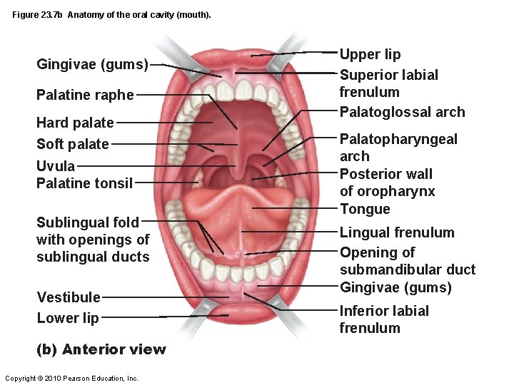 Figure 23. 7 b Anatomy of the oral cavity (mouth). Gingivae (gums) Palatine raphe
