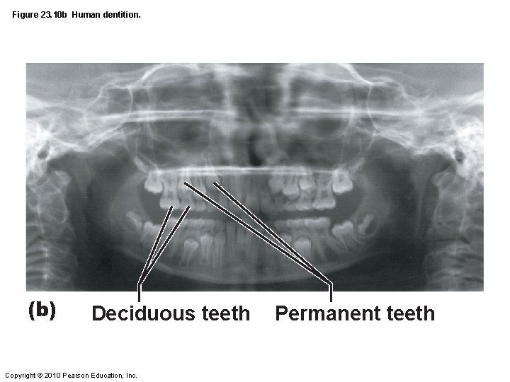 Figure 23. 10 b Human dentition. (b) Deciduous teeth Copyright © 2010 Pearson Education,