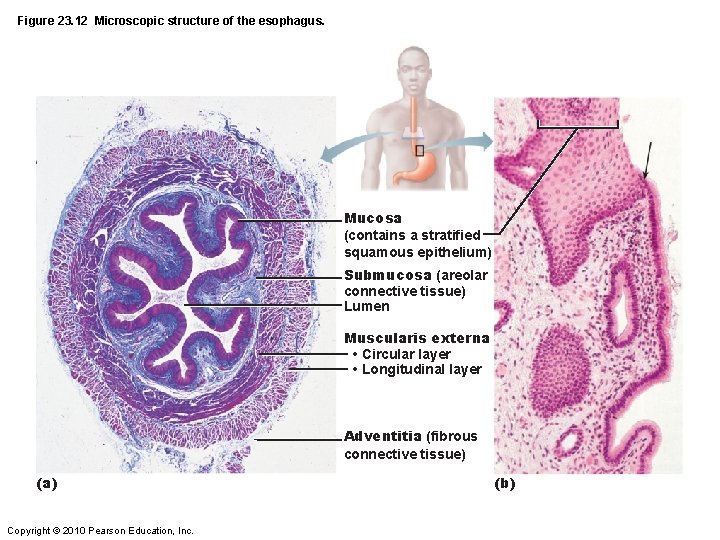Figure 23. 12 Microscopic structure of the esophagus. Mucosa (contains a stratified squamous epithelium)
