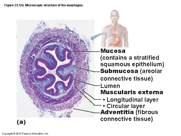Figure 23. 12 a Microscopic structure of the esophagus. (a) Copyright © 2010 Pearson