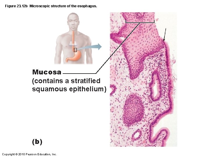 Figure 23. 12 b Microscopic structure of the esophagus. Mucosa (contains a stratified squamous