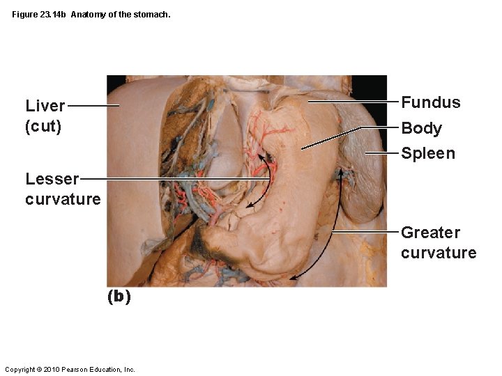 Figure 23. 14 b Anatomy of the stomach. Fundus Liver (cut) Body Spleen Lesser