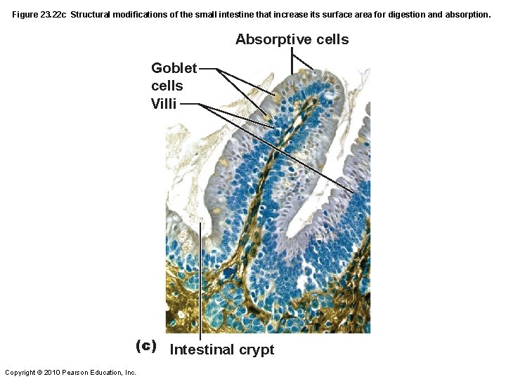 Figure 23. 22 c Structural modifications of the small intestine that increase its surface