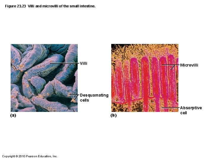 Figure 23. 23 Villi and microvilli of the small intestine. Villi Microvilli Desquamating cells