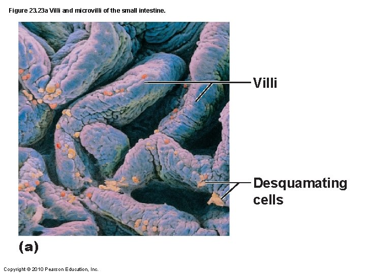 Figure 23. 23 a Villi and microvilli of the small intestine. Villi Desquamating cells