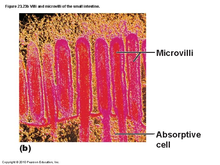 Figure 23. 23 b Villi and microvilli of the small intestine. Microvilli (b) Copyright