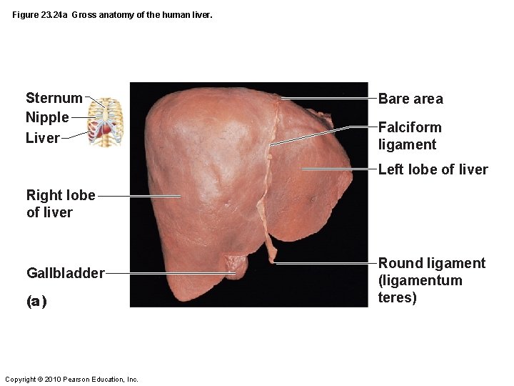Figure 23. 24 a Gross anatomy of the human liver. Sternum Nipple Liver Bare