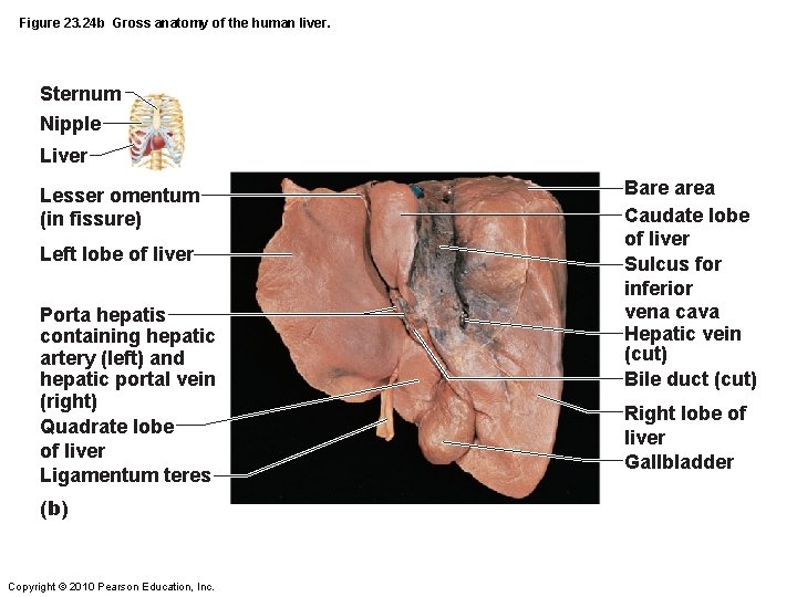 Figure 23. 24 b Gross anatomy of the human liver. Sternum Nipple Liver Lesser