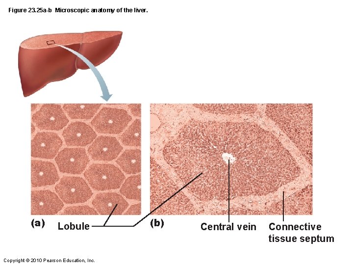 Figure 23. 25 a-b Microscopic anatomy of the liver. (a) Lobule Copyright © 2010