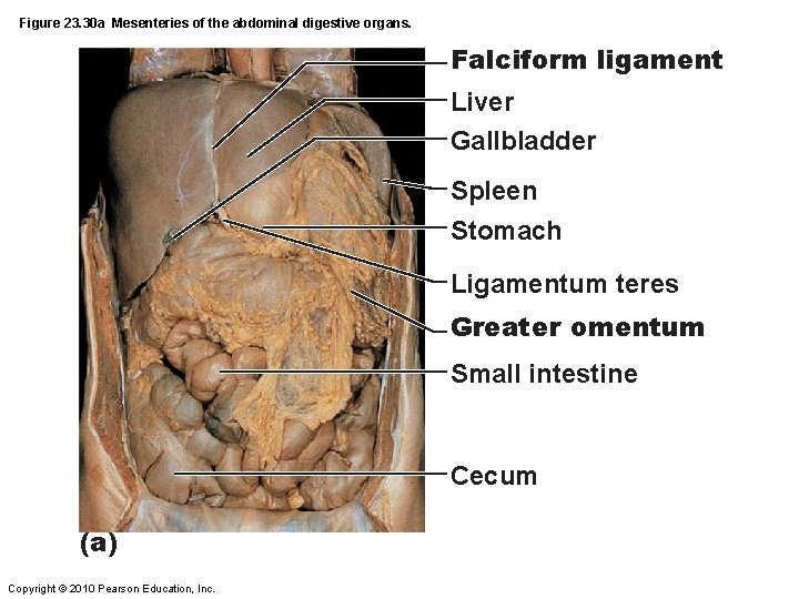 Figure 23. 30 a Mesenteries of the abdominal digestive organs. Falciform ligament Liver Gallbladder