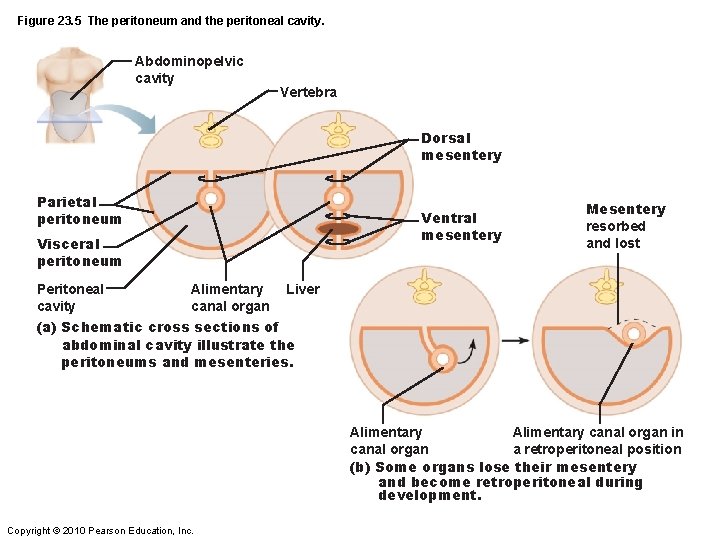 Figure 23. 5 The peritoneum and the peritoneal cavity. Abdominopelvic cavity Vertebra Dorsal mesentery