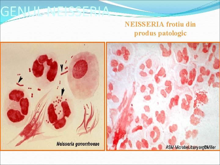 GENUL NEISSERIA frotiu din produs patologic 